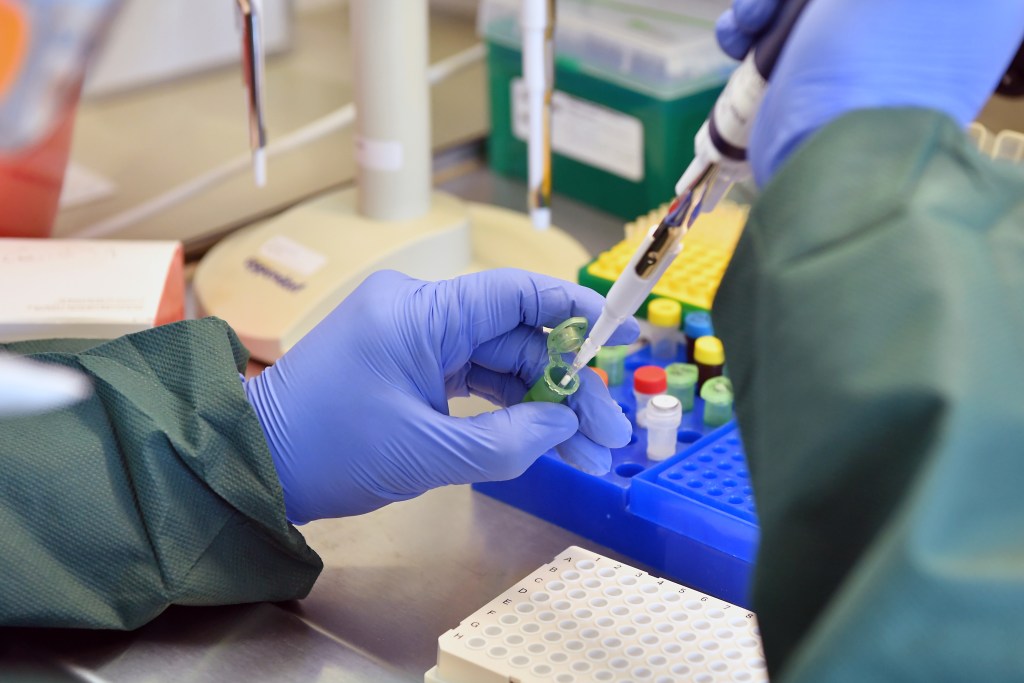 A photograph of gloved hands preparing a sample for a reverse transcription polymerase chain reaction (RT-PCR) to detect the COVID-19 disease